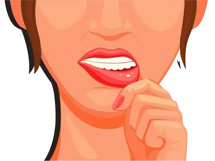 canker-sores key visual