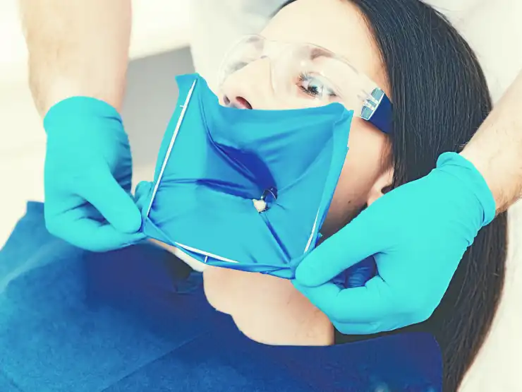 Patient with a rubber dam on a tooth during root canal treatment