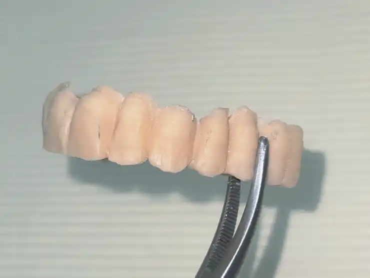 Temporary dental crowns that are not yet cemented on teeth