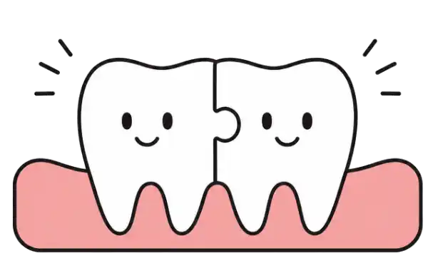 Illustration of a two separate tooth buds merging into one fused tooth.