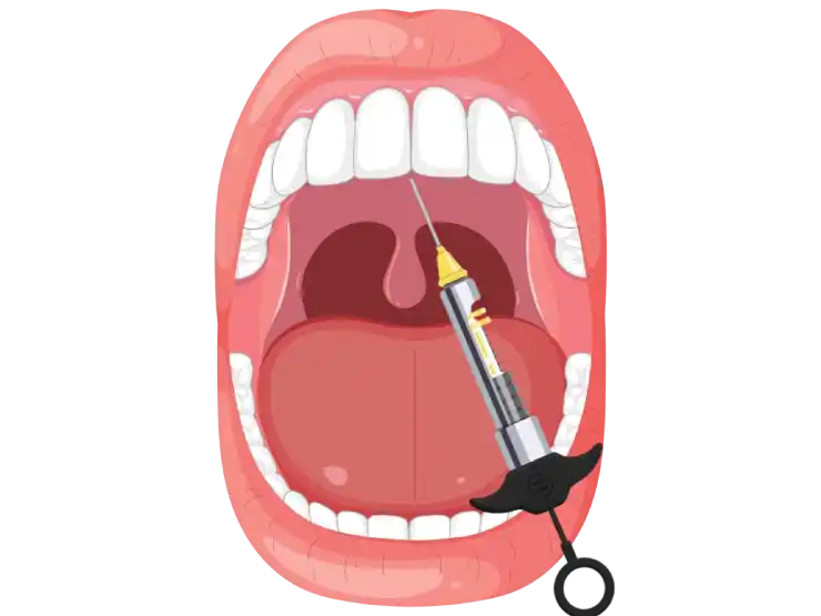 Roof of Mouth Sore After a Dental Injection? Why It Hurts - Key Visual
