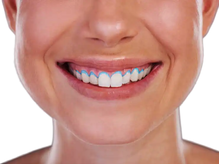 Teeth close-up showing the neck of the tooth where it meets the gums.