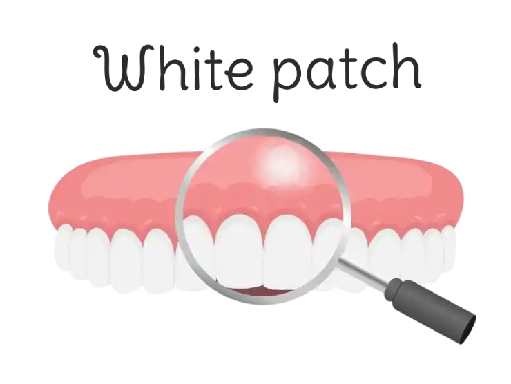 Gum Turned White After a Dental Injection? What It Means - Key Visual